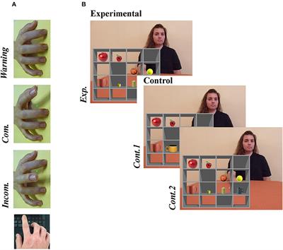 Impaired Self-Other Distinction and Subcortical Gray-Matter Alterations Characterize Socio-Cognitive Disturbances in Multiple Sclerosis